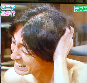カツラ ナイナイ 矢部 岡村隆史、薄毛を克服「3階から見られても恐くない！」 頭髪治療のCMに起用される